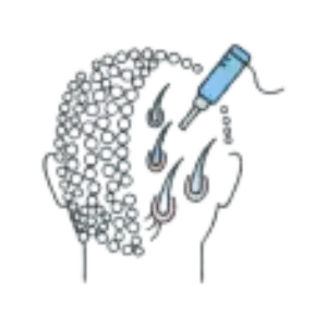 3.	برداشت مو از پشت سر