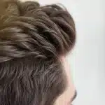 ماندگاری کاشت مو