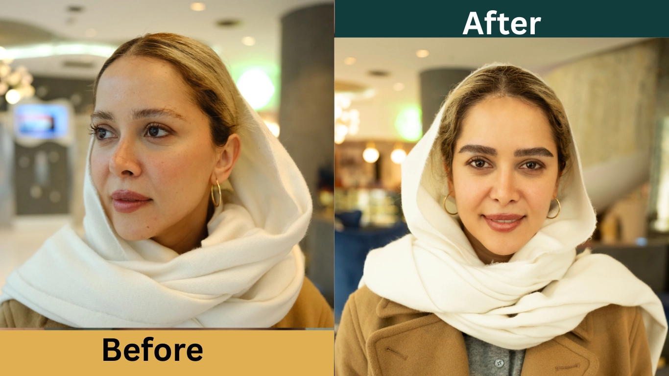 قبل و بعد از کاشت ابرو