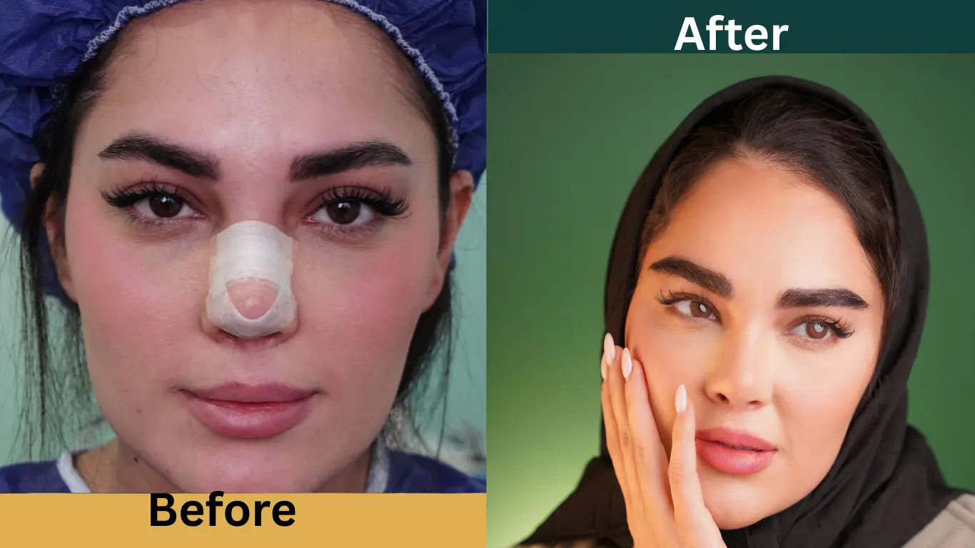 ماندگاری کاشت ابرو